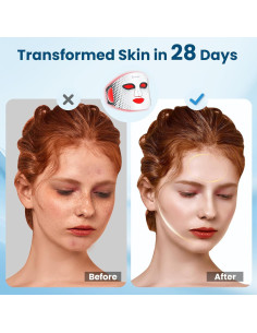 Máscara de Terapia de Luz LED Lovsheme T1 para Piel Radiante 2