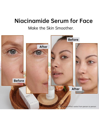 Suero Facial de Niacinamida 10% + Zinc 1% MIZEEYE 30ml