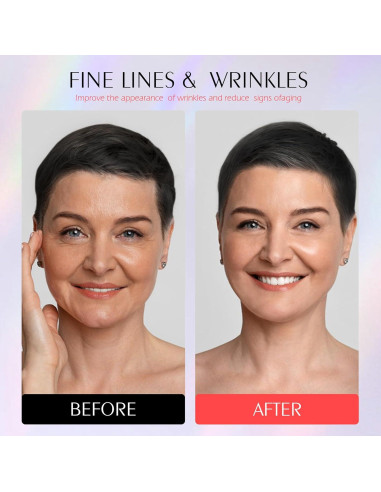 Máscara de Terapia de Luz Roja Photonstar LED Facial 660nm 850nm