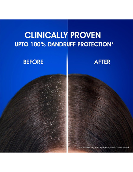 Champú Anticaspa Head & Shoulders Mentol Fresco 1L Champú Anticaspa Head & Shoulders Mentol Fresco 1L