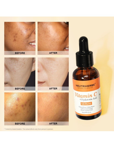 Suero Facial de Vitamina C Neutriherbs 29.57 ml con Ácido Hialurónico