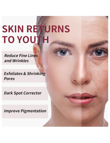 Peeling Químico Facial YAFUSIPE AHA 30% BHA 2% 28g