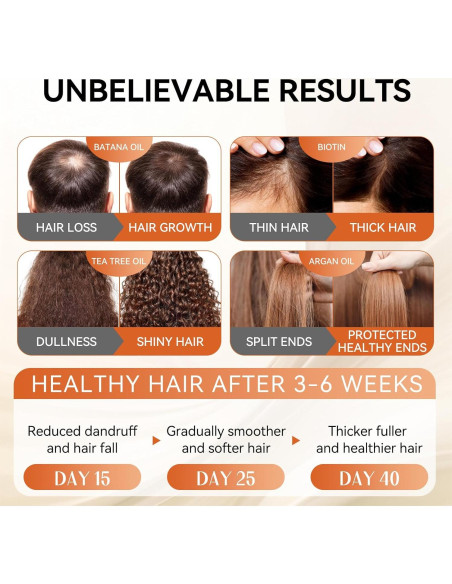 Juego de Champú y Acondicionador LABJD Aceite de Ricino 500ml