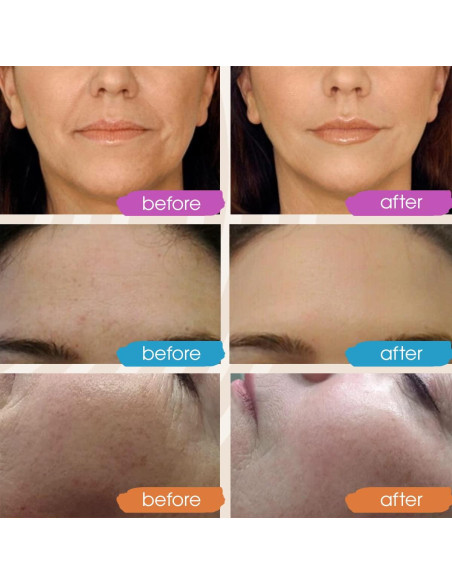 Suero Facial GLEOW Vitamina C y Ácido Hialurónico 56.7ml Suero Facial GLEOW Vitamina C y Ácido Hialurónico 56.7ml