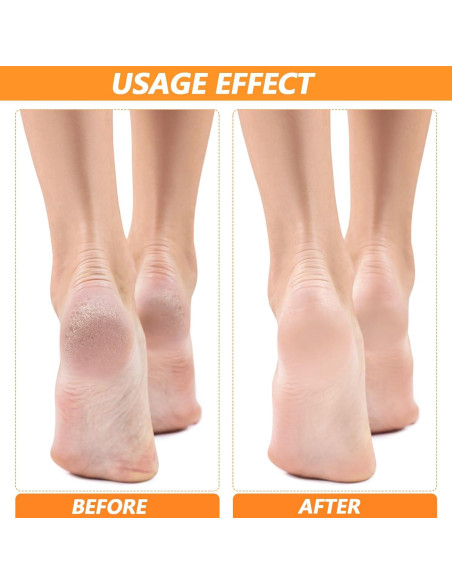 4 Pares Protectores de Talón de Gel Silicona TIESOME Alivio Dolor