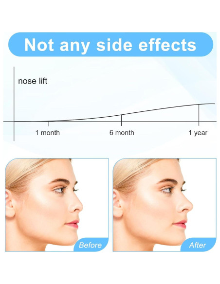 Lifter de Nariz XLIUAX - Modelador Invisible Reutilizable 18 Piezas