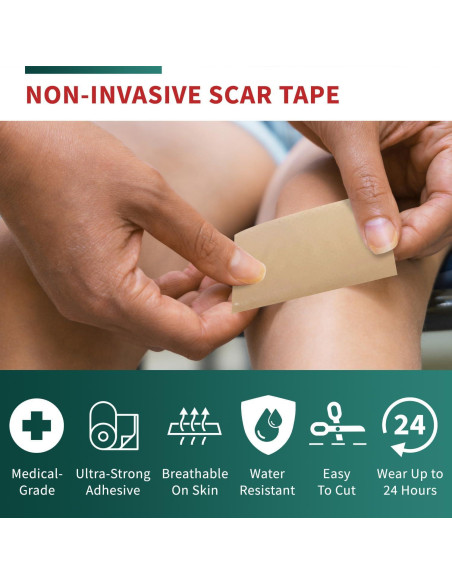 Cinta de Cicatriz de Silicona Protect Life 4.06 cm x 299.72 cm Cinta de Cicatriz de Silicona Protect Life 4.06 cm x 299.72 cm
