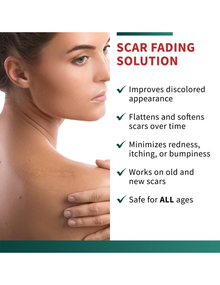 Cinta de Cicatriz de Silicona Protect Life 4.06 cm x 299.72 cm Cinta de Cicatriz de Silicona Protect Life 4.06 cm x 299.72 cm