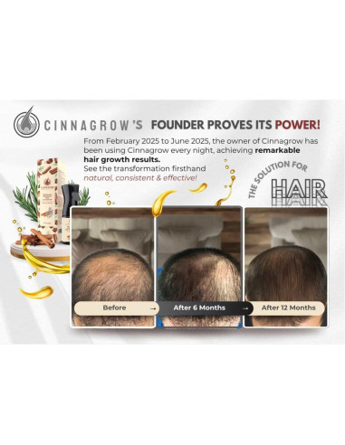 Aceite Natural Cinnagrow para Crecimiento del Cabello 60 ml