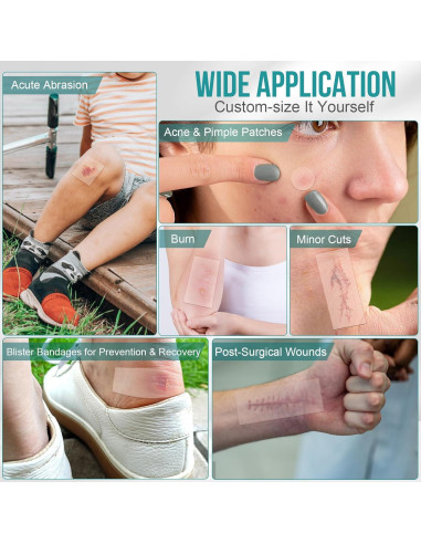 Rollos de hidrocoloide YHOVID 7.62cm x 2.44m para heridas