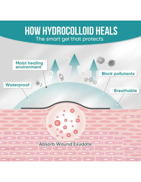 Rollos de hidrocoloide YHOVID 7.62cm x 2.44m para heridas