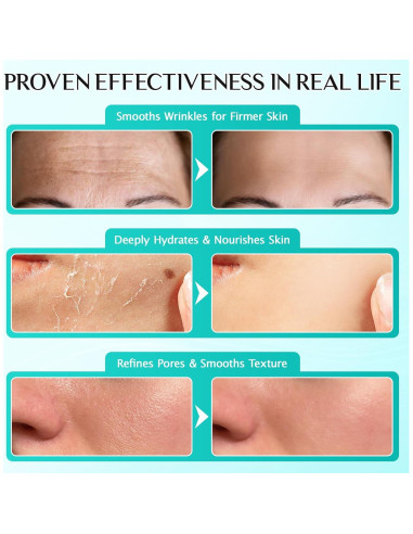 Suero Facial Hidratante 3% Ácido Hialurónico Meifenla 30 Viales