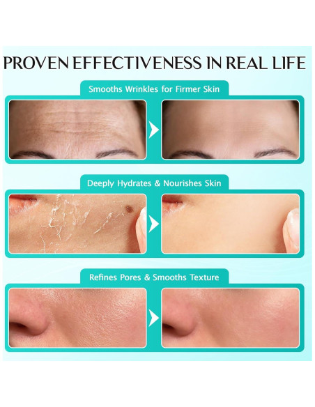 Suero Facial Hidratante 3% Ácido Hialurónico Meifenla 30 Viales