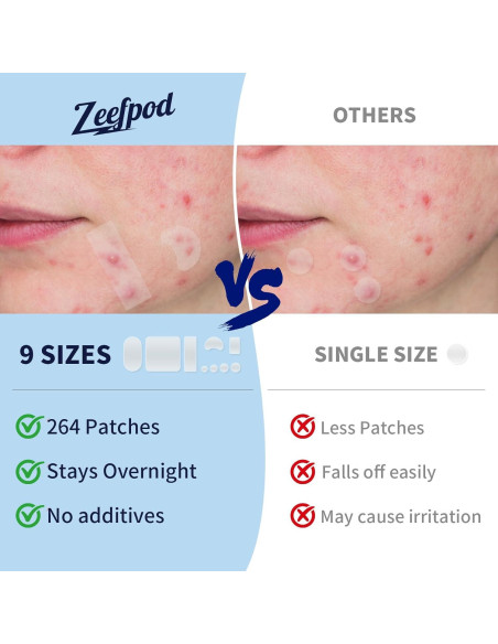 Parches para Espinillas Zeefpod XL - 264 Unidades, 9 Tamaños