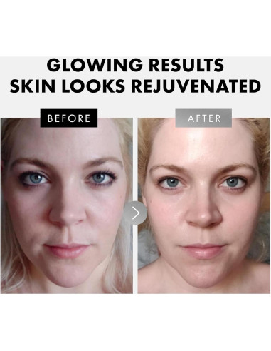 Set de Sueros Faciales Eclat Skincare - Vitamina C, Retinol y Ácido Hialurónico