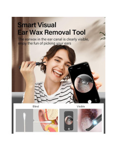 Limpiador de Oídos Bebird con Cámara 1080P y 8 Cucharas de Silicona 2