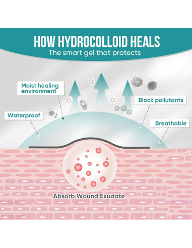 3 Rollos de Hidrocoloide YHOVID para Cuidado de Heridas 5.08cm