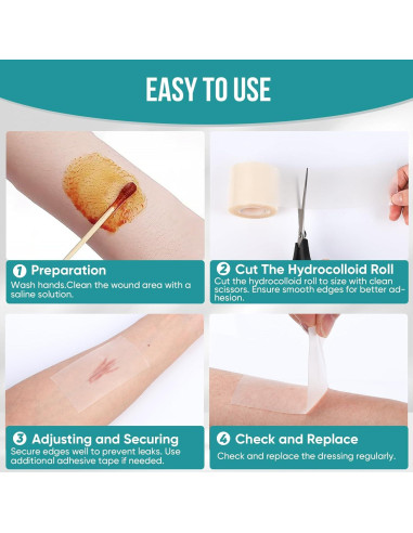3 Rollos de Hidrocoloide YHOVID para Cuidado de Heridas 5.08cm