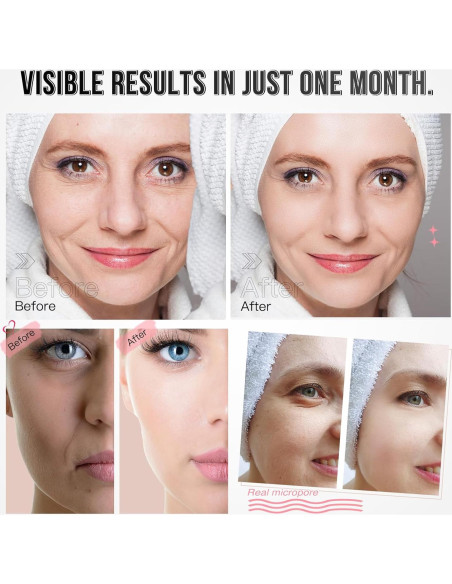 Máscara Facial LED Terapia de Luz IBORRIA 3 Colores 32x23cm