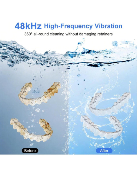 Limpiador Ultrasónico Dental Aculya SC-194 200ml Blanco