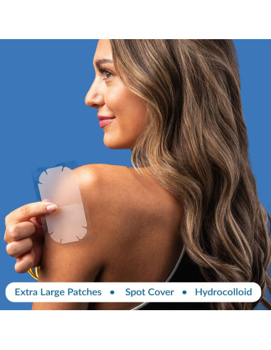 Parches para Granos Extra Grandes EZACNE - Hidrocoloide Médico 5 Unidades