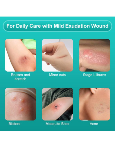 Vendaje Hidrocoloide Dimora 10 Parches 10x10 cm Estéril Impermeable