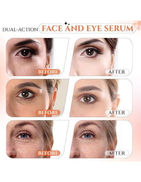 Suero Facial Vitamina C 20% Ragkun 29.57 ml Antienvejecimiento