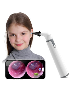 Otoscopio WiFi 720p HD Feng Rao con Luz LED y Doble Vista