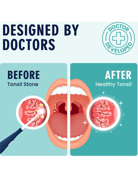 Kit de Remoción de Piedras de Amígdalas Dr. Frederick - 8 Piezas