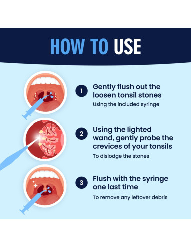 Kit de Remoción de Piedras de Amígdalas Dr. Frederick - 8 Piezas
