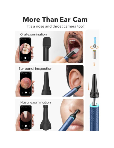 Bebird M9 Kit de Limpieza de Oídos con Cámara 1080p HD