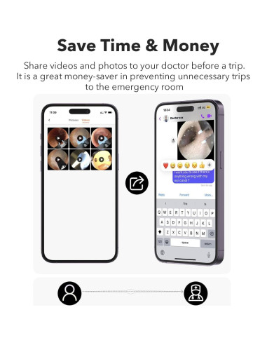 Bebird M9 Kit de Limpieza de Oídos con Cámara 1080p HD