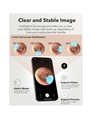 Bebird M9 Kit de Limpieza de Oídos con Cámara 1080p HD