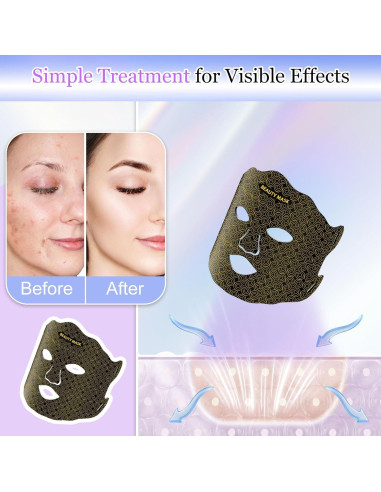 Máscara de Terapia de Luz Roja SECOCTSR 7 Colores 3 Brillos