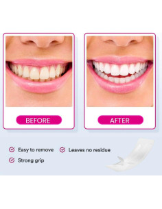 Tiras Blanqueadoras de Dientes VELAMO para Sensibles - 14 Tratamientos 2