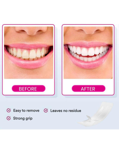 Tiras Blanqueadoras de Dientes VELAMO para Sensibles - 14 Tratamientos