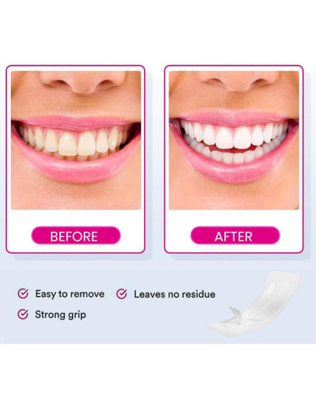 Tiras Blanqueadoras de Dientes VELAMO para Sensibles - 14 Tratamientos