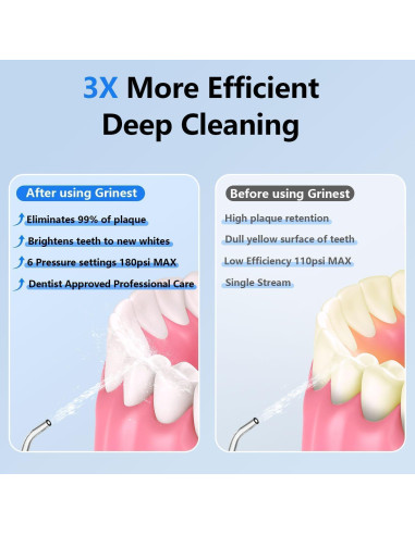 Irrigador Oral Inalámbrico Grinest 7 Modos Negro IPX7