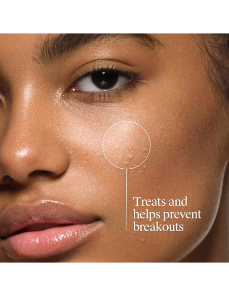 Limpiador Facial Sin Aceite Neutrogena 269 ml - Acné 2% Ácido Salicílico Limpiador Facial Sin Aceite Neutrogena 269 ml - Acné 2% Ácido Salicílico