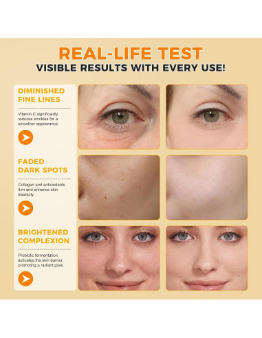 Suero Facial Antienvejecimiento Ruduwu 60ml - Vitamina C y E