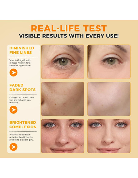 Suero Facial Antienvejecimiento Ruduwu 60ml - Vitamina C y E Suero Facial Antienvejecimiento Ruduwu 60ml - Vitamina C y E