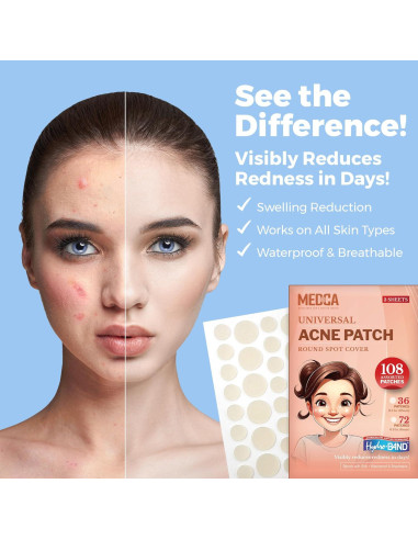Parche Hidrocoloide para Acné MEDca - 108 Unidades en 2 Tamaños