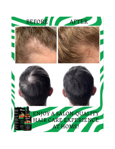 Aceite de Batana y Romero DAIEME 60 ml - Crecimiento Cabello