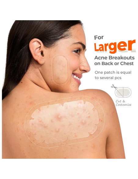 Parches para Acné Corporal TKTK XXL - 110 Piezas Hidrocoloide