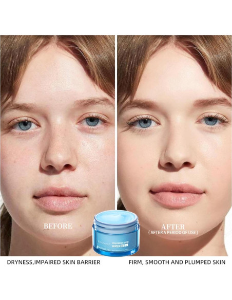 Gel de Agua Hidratante Facial ZAMANIYA 50g - Piel Grasa