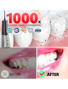 Irrigador Dental G.CATACC Kids 300ml 4 Puntas Recargable 2