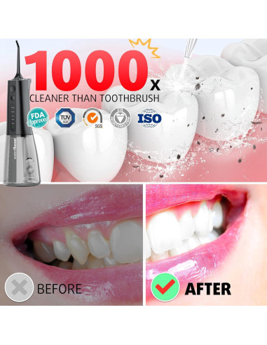 Irrigador Dental G.CATACC Kids 300ml 4 Puntas Recargable