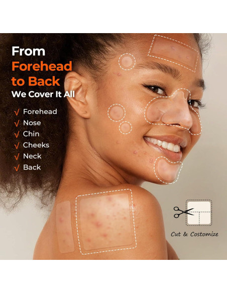 Parches para Acné TKTK Hidrocoloide 356 Unidades 6 Tamaños Parches para Acné TKTK Hidrocoloide 356 Unidades 6 Tamaños