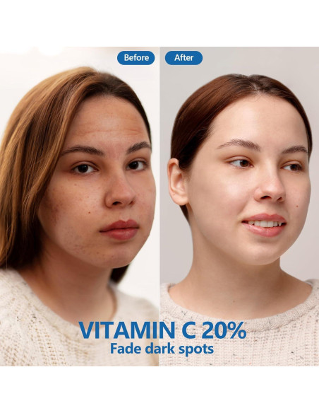 Suero Facial Vitamina C 20% Dmsky con Ácido Hialurónico 181g Suero Facial Vitamina C 20% Dmsky con Ácido Hialurónico 181g