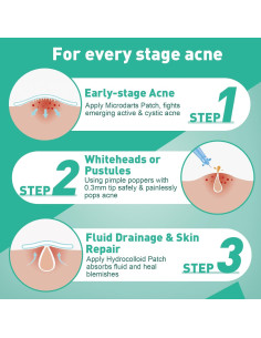 Set de Parches para Granitos Microdart TEAWOO - 83 Unidades 2